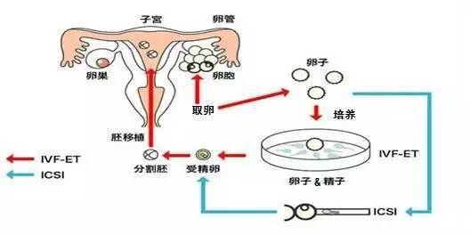 辅助生殖技术中取卵操作及收费标准探讨